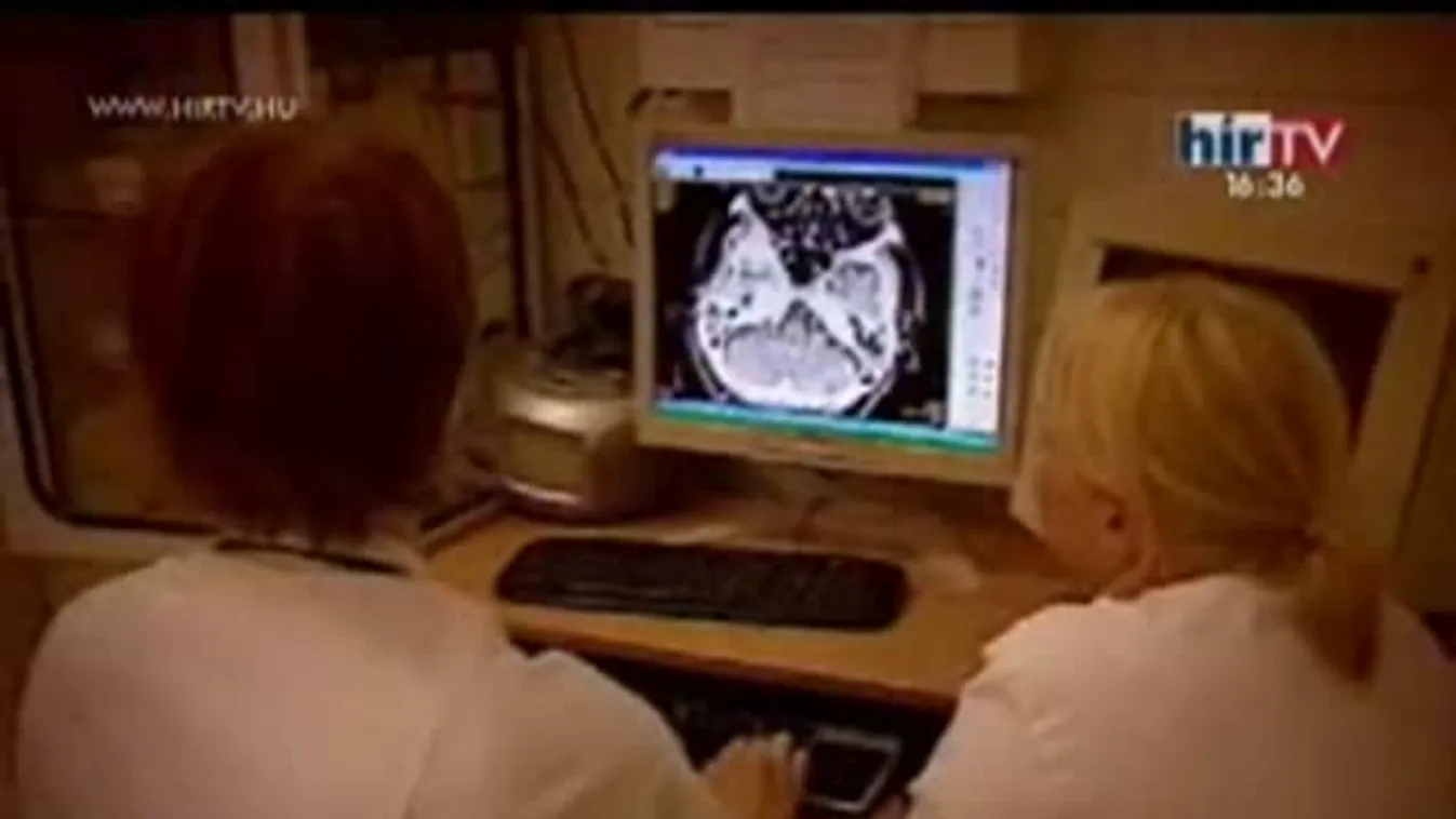 A stroke és a pitvarfibrilláció kapcsolata – Gyógyhír