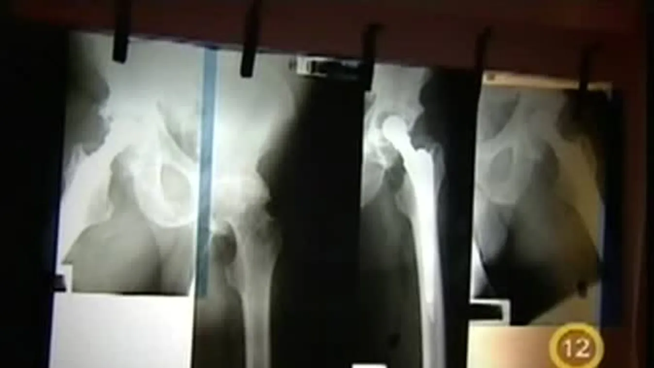 Kivárhatatlan várólisták – Gyógyhír