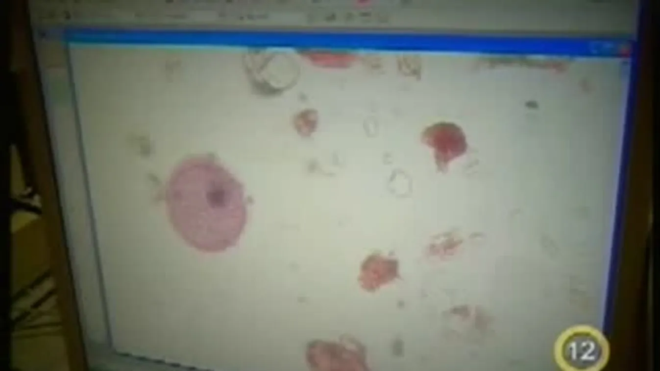 Lassan mindenki allergiás lesz?/ Apiterápia – Gyógyhír