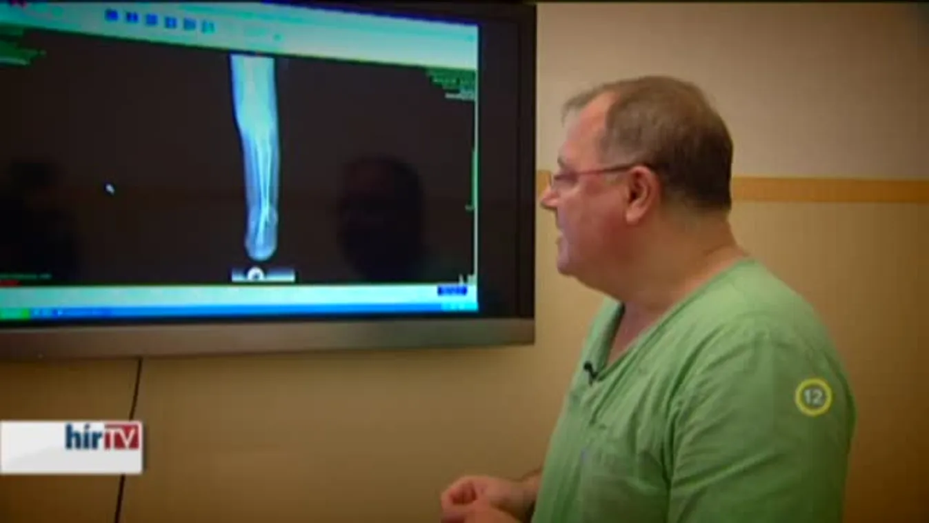 Gyógyhír – Gyermekortopédiai különlegesség