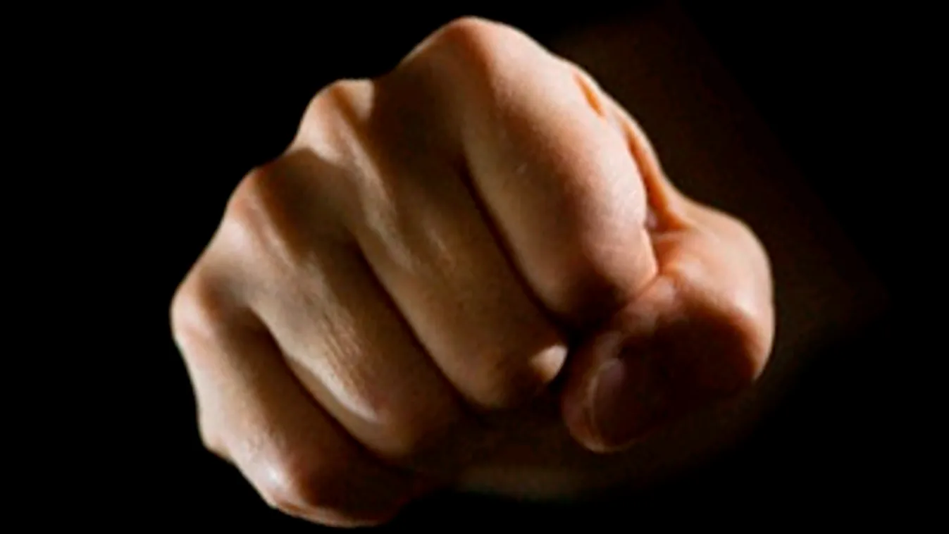 Milliókat kaphat a megvert roma férfi