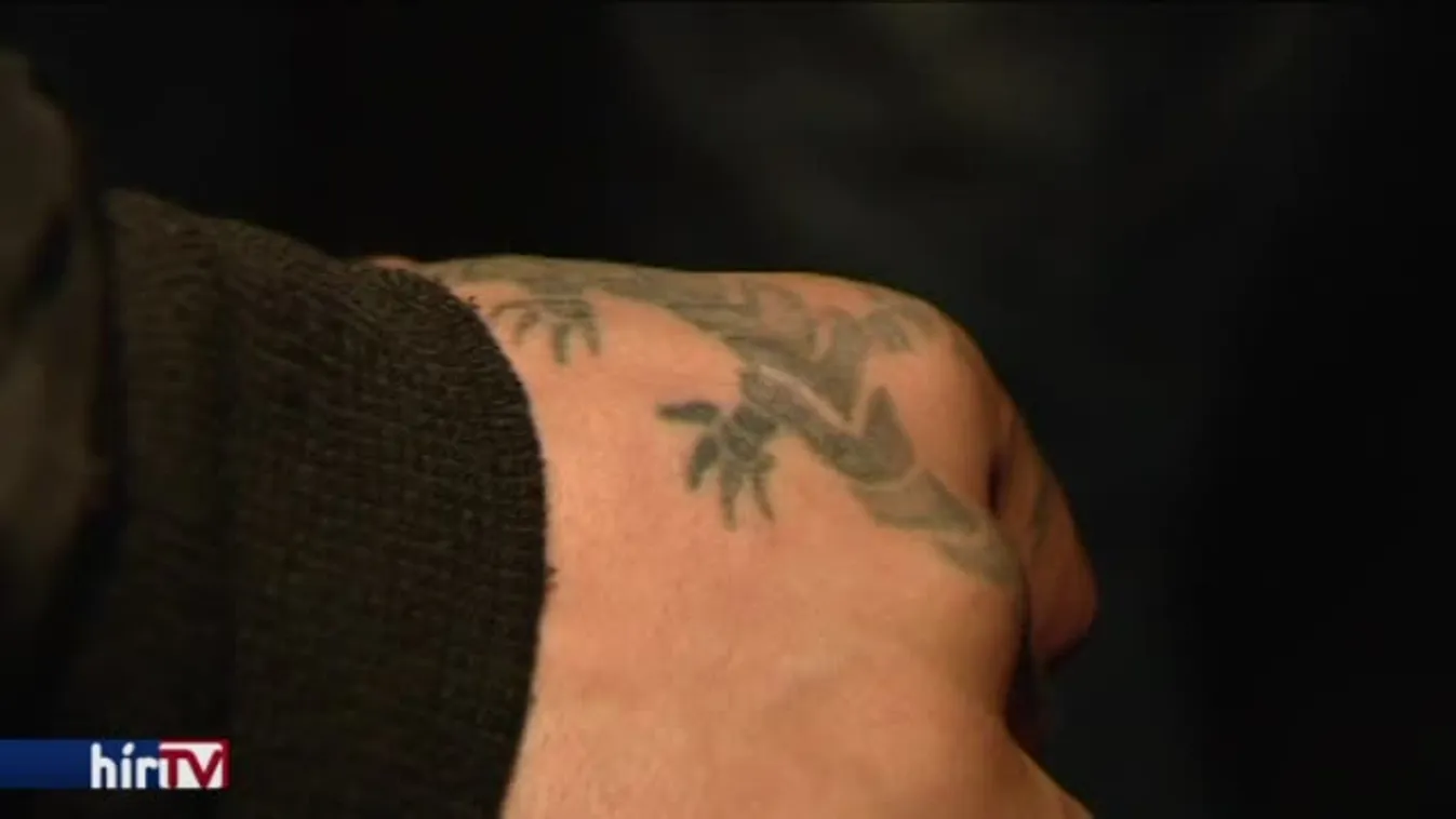 Napról napra - Kopaszok