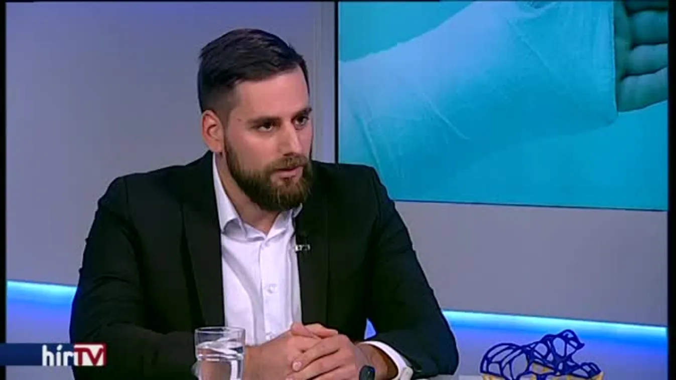 Magyarország élőben – 3D-s gipsz