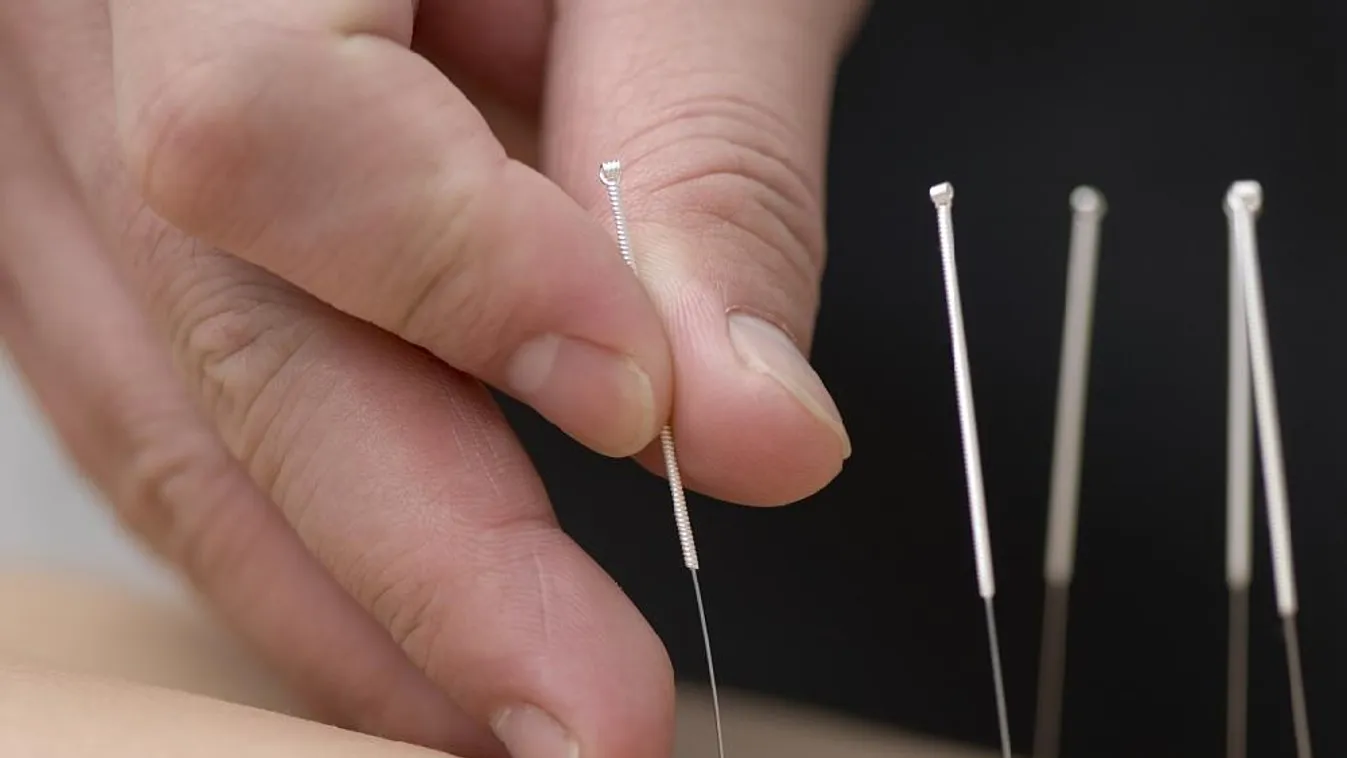 Gyógytű – Ázsia