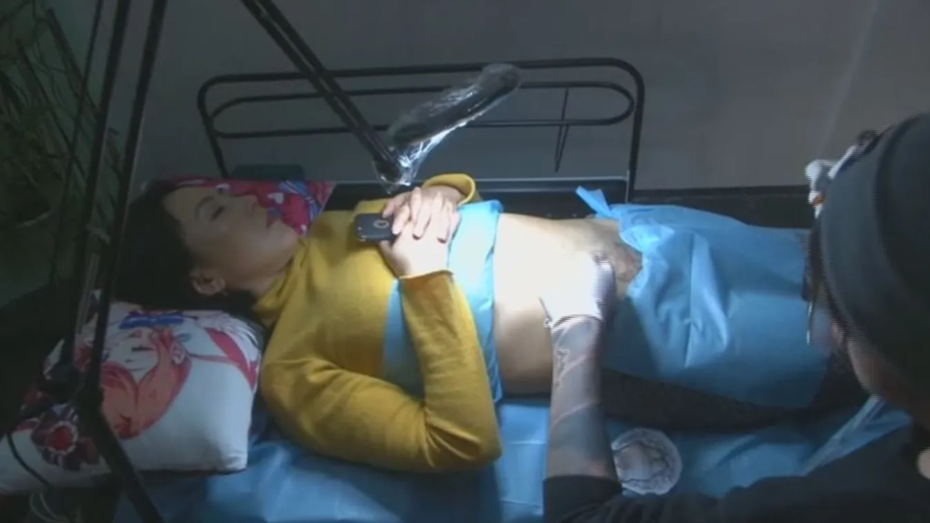 Hasfelmetszés – Felfedező