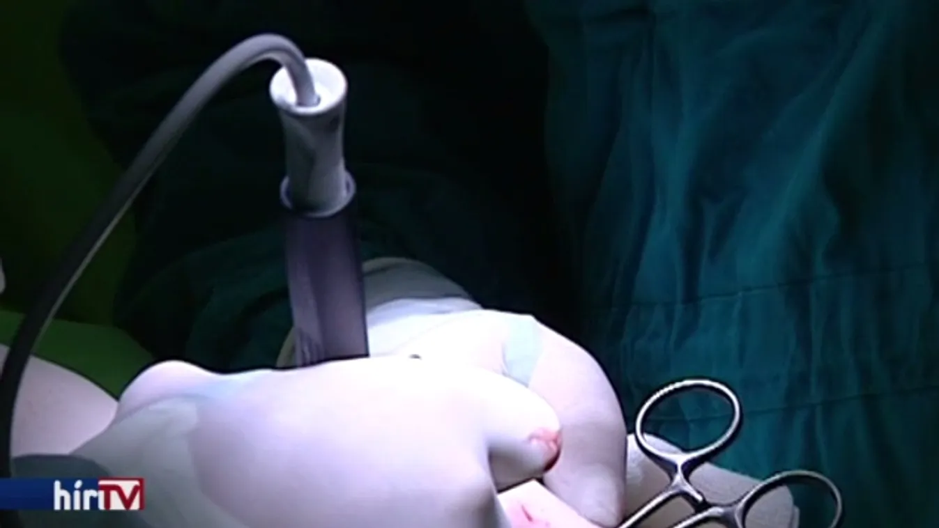 Tízezrek halála lett volna elkerülhető