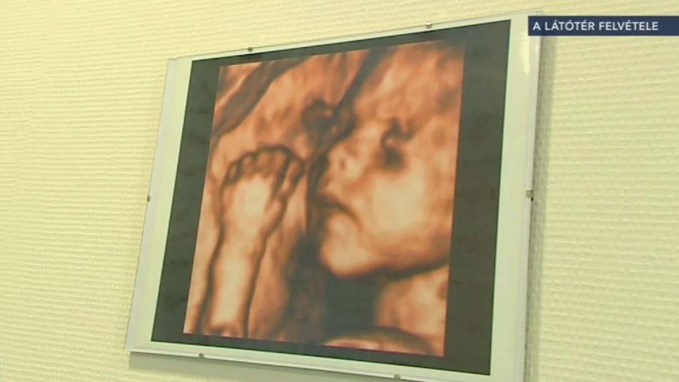 Az újabb Ratkó-korszakra még várni kell