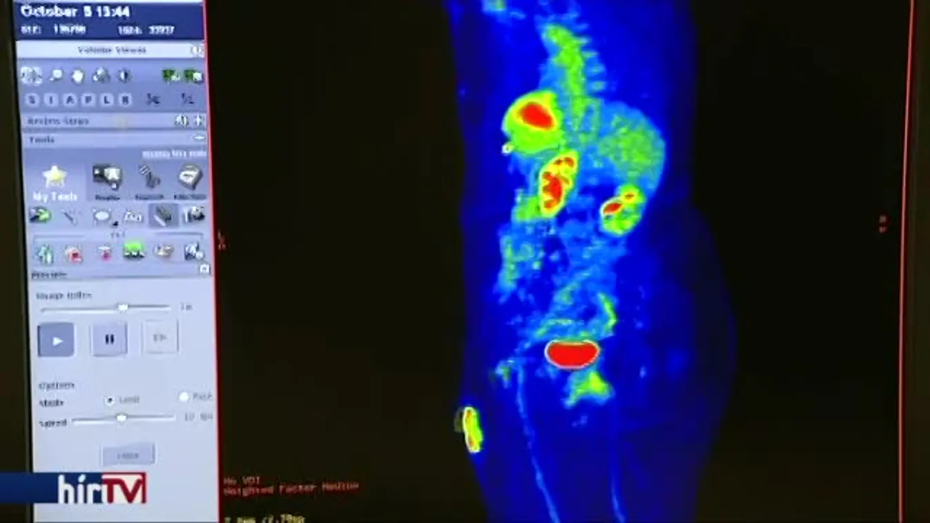 Hiába van horror áron, egyre nagyobb üzlet a magánellátás