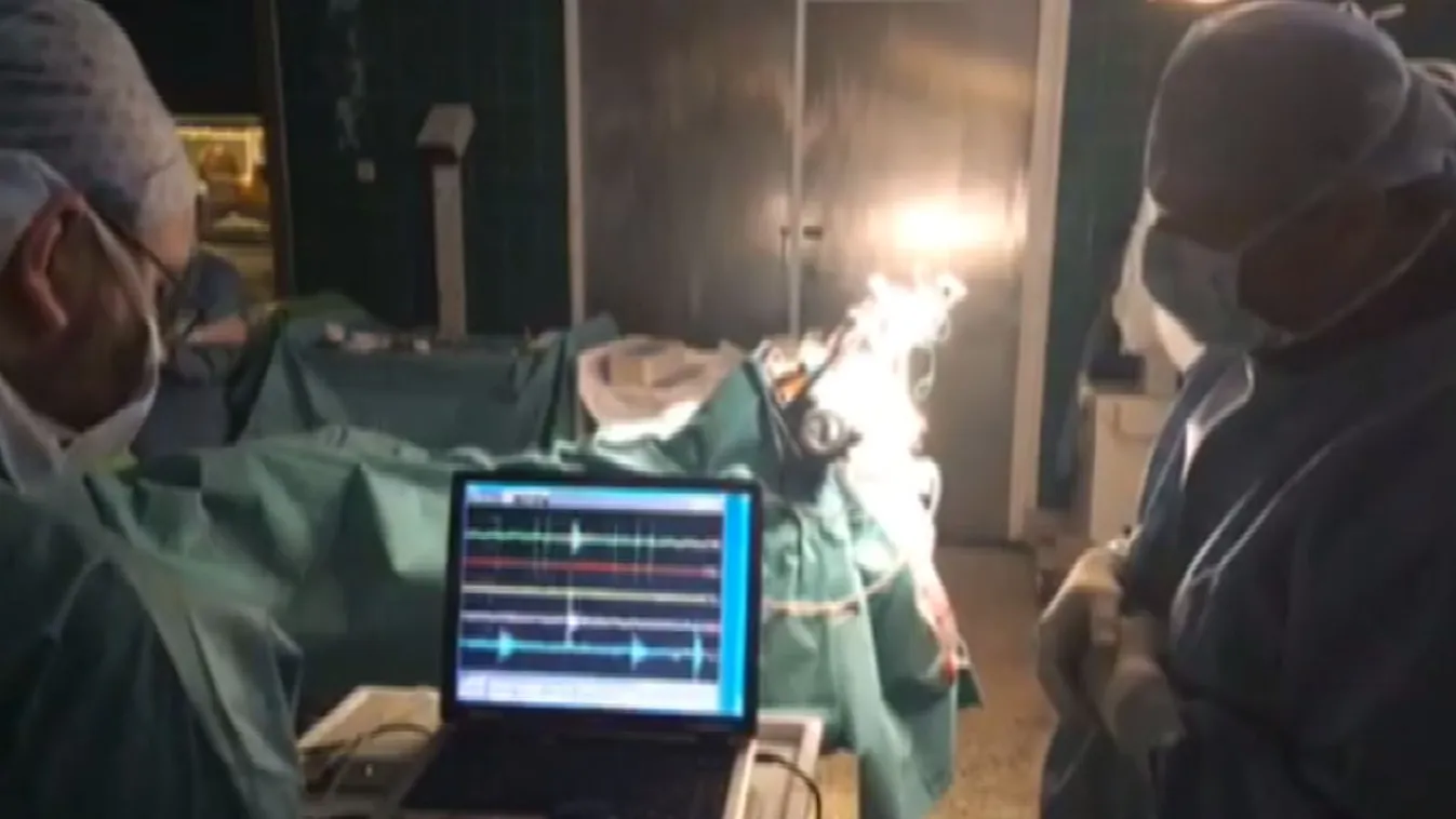 Élőben közvetítettek agyműtétet