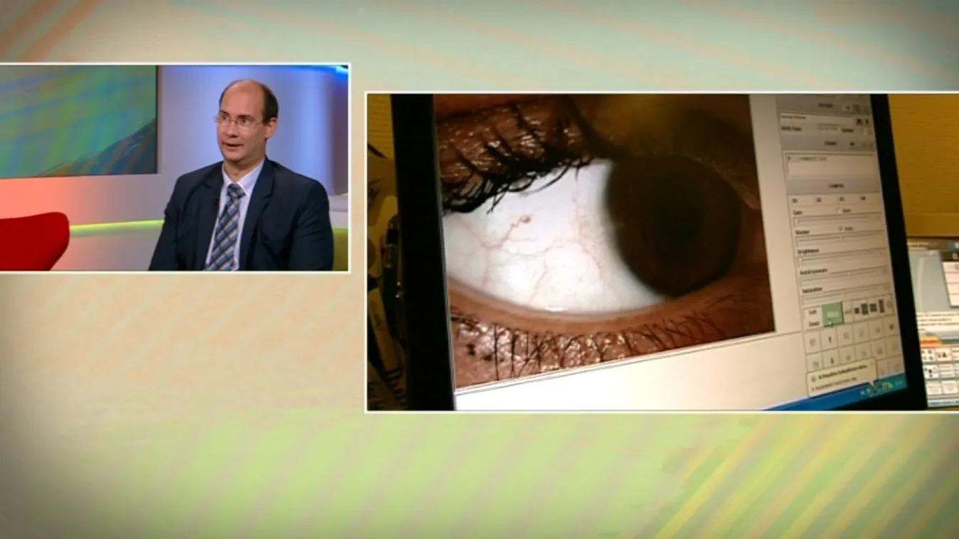 Ne keverje össze az allergiás tünetekkel!