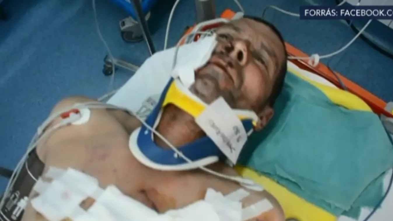 Ismét súlyos medvetámadás történt Székelyföldön