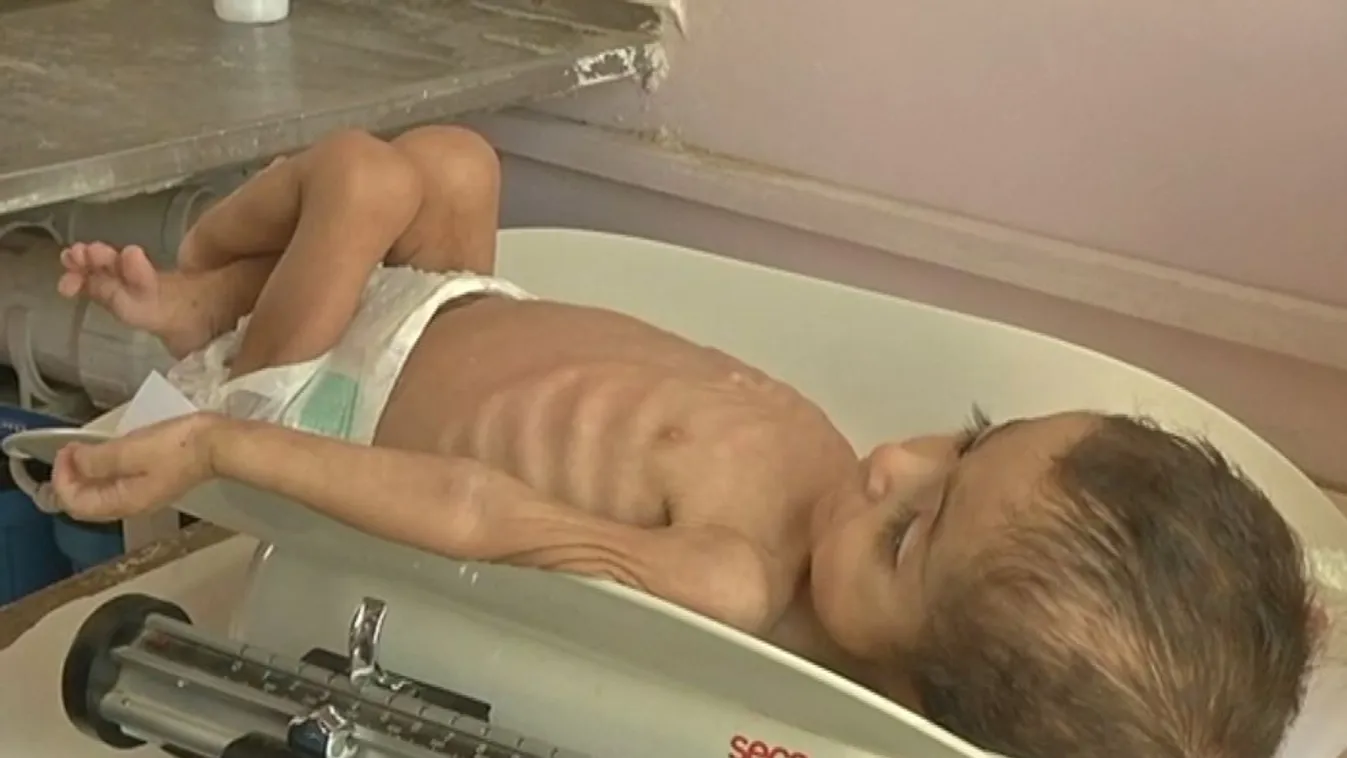 Több mint 4 millió gyereket fenyeget az éhhalál