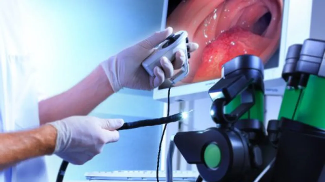 Sajnos ebben világelsők vagyunk