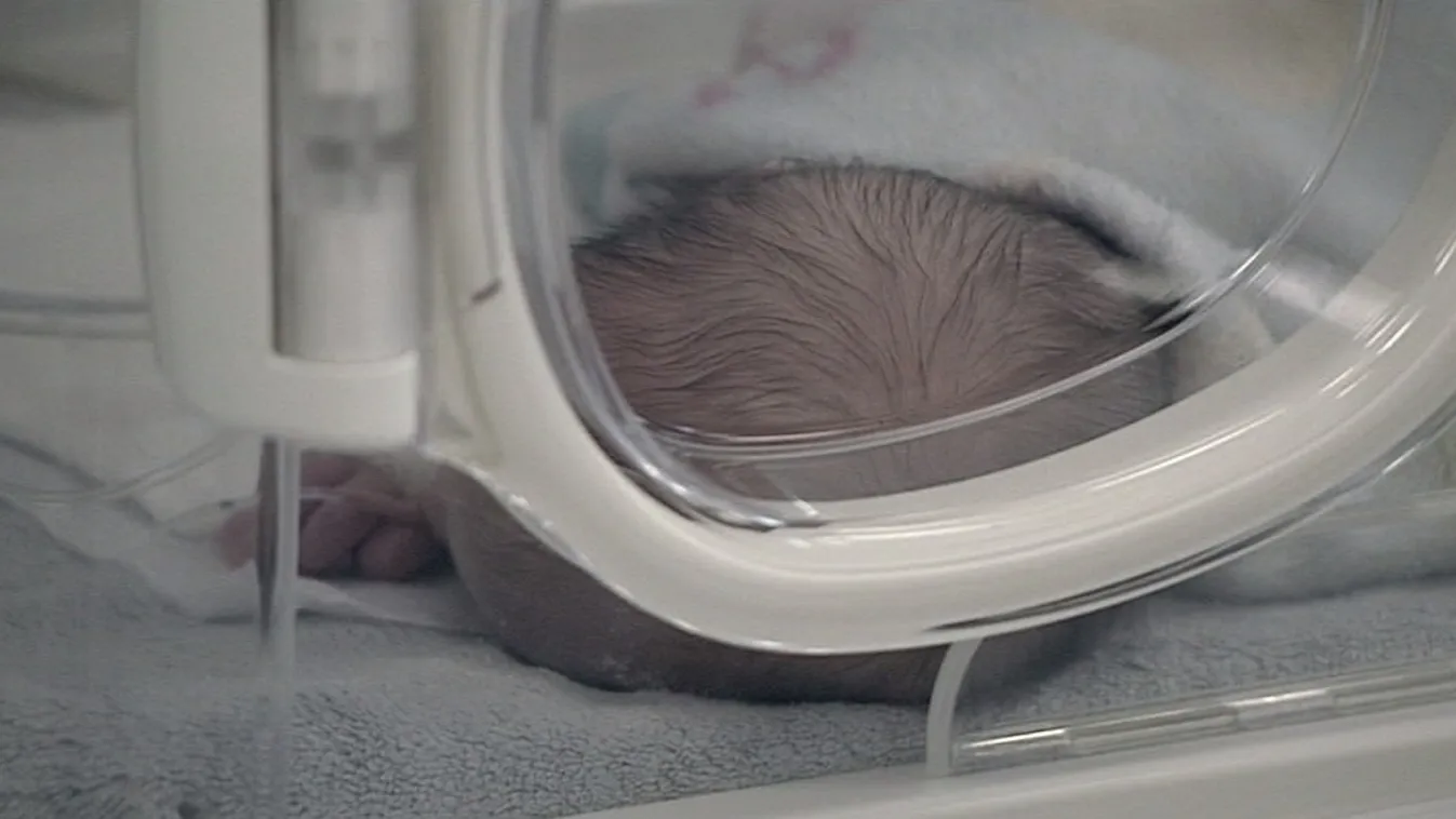 A baba a rendelőben már alig kapott levegőt, nem sokkal később meghalt