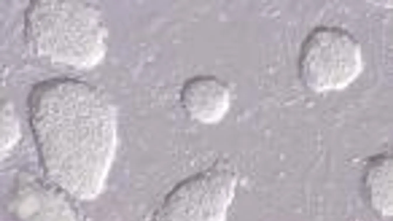 Nyomoz a rendőrség az egyik legnagyobb őssejt banknál