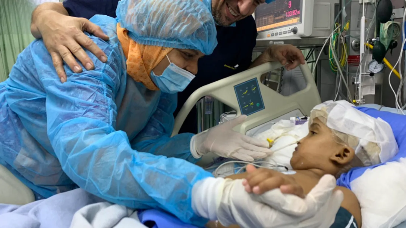 Úttörő módon választották szét a sziámi ikreket a magyar orvosok