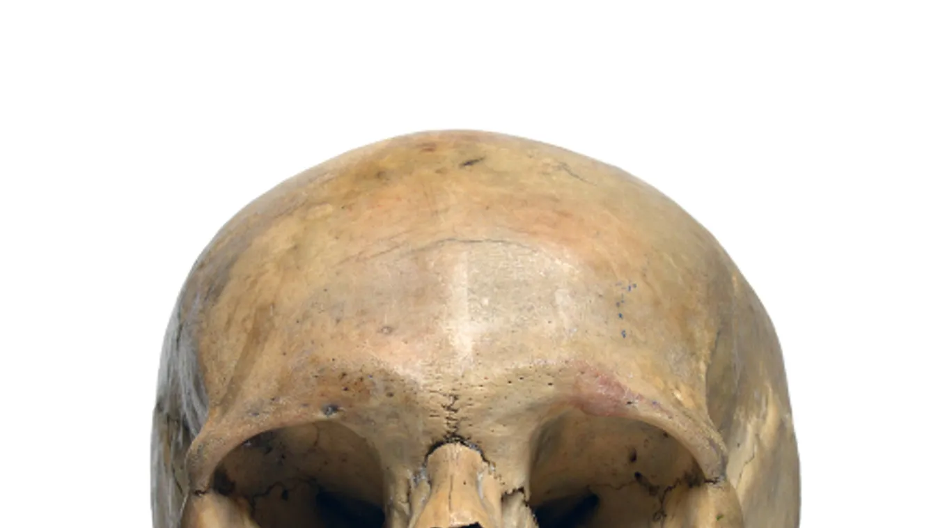 Koponyatorzítás mutatta meg az összetartozást és a társadalmi státuszt a hun korban