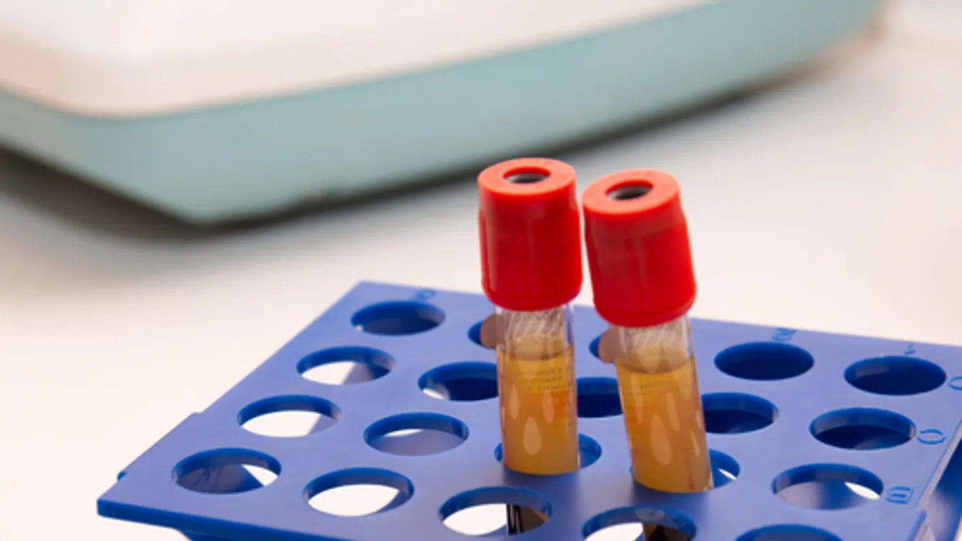 Lacza Zsombor: újabb donoroktól vettek vérplazmát súlyos koronavírus-betegek gyógyításához