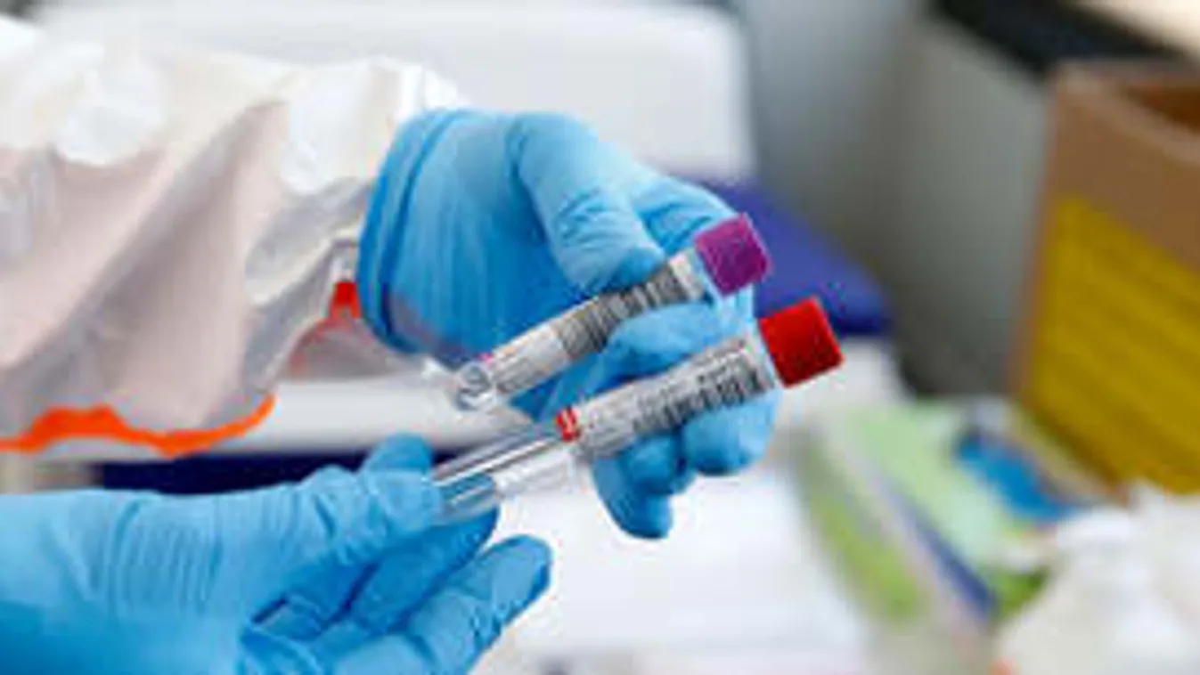 Hazánkban valóban alacsony az átfertőzöttség mértéke