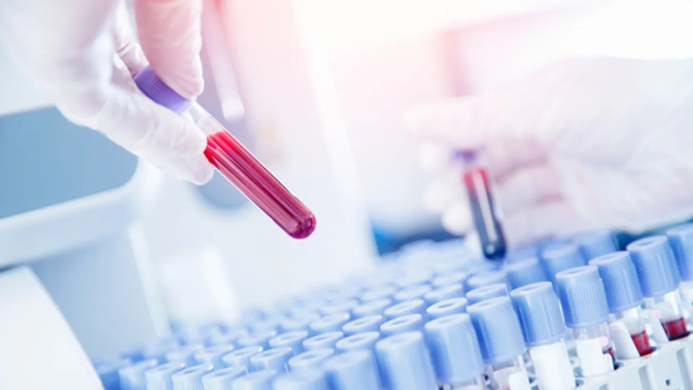 Jók a vérplazmakezelés tapasztalatai