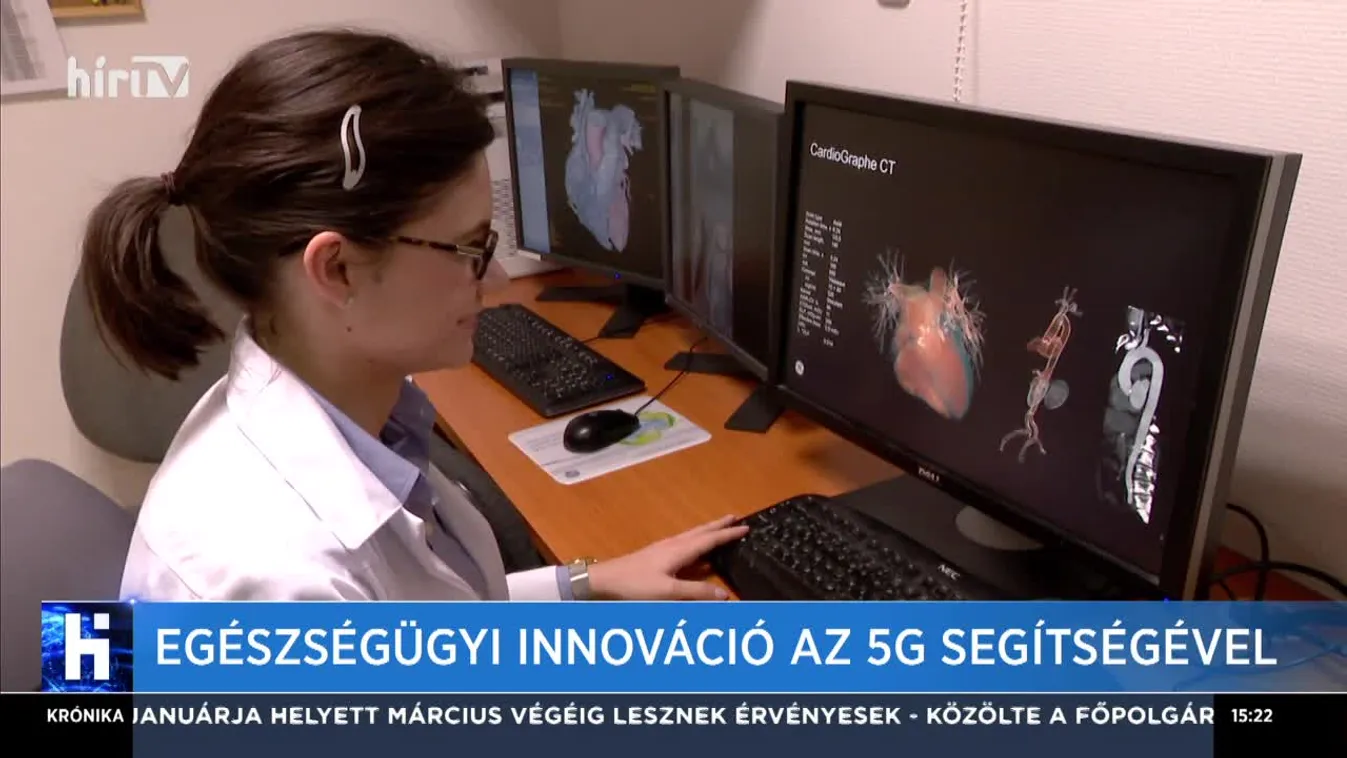 Egészségügyi innováció az 5G segítségével