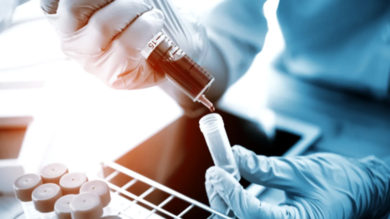 Száznál több beteget gyógyított meg a vérplazma-terápia