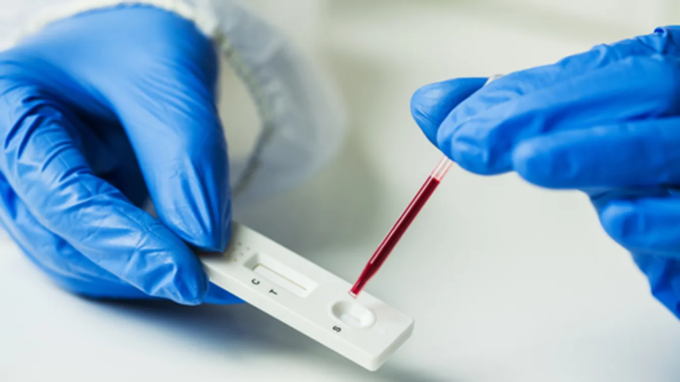 Csütörtök estig lehet jelentkezni az óvodai, iskolai dolgozók gyorstesztelésére