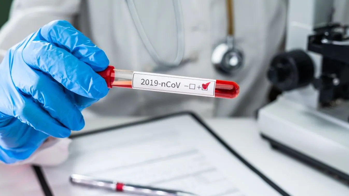 2982-vel emelkedett a beazonosított fertőzöttek száma és elhunyt 157 beteg