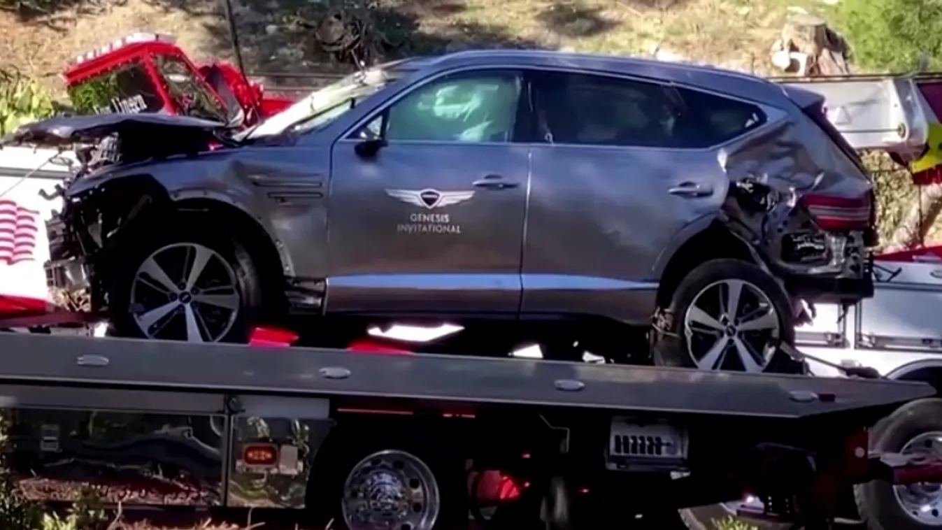 Túl van a műtéten az autóbalesetben megsérült Tiger Woods