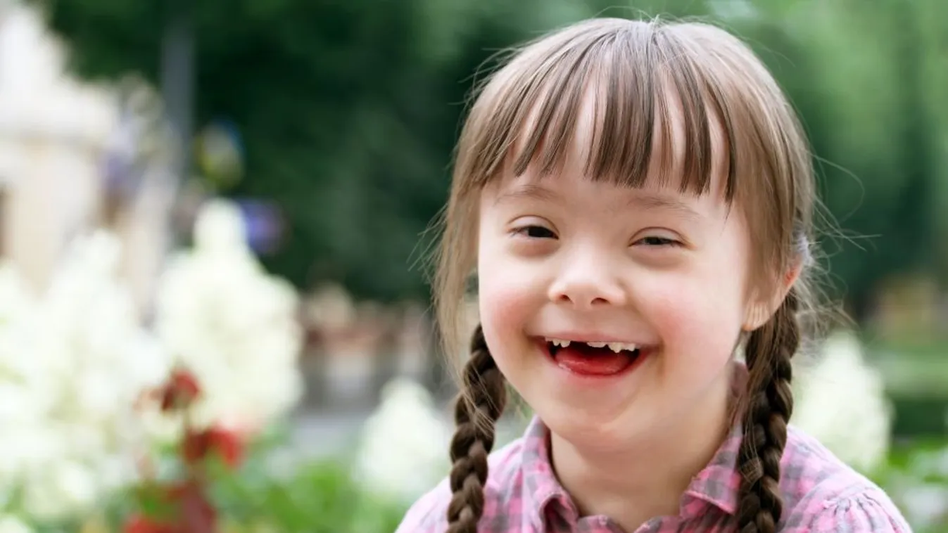 Down-szindrómás gyermekeket támogat a Mészáros Csoport