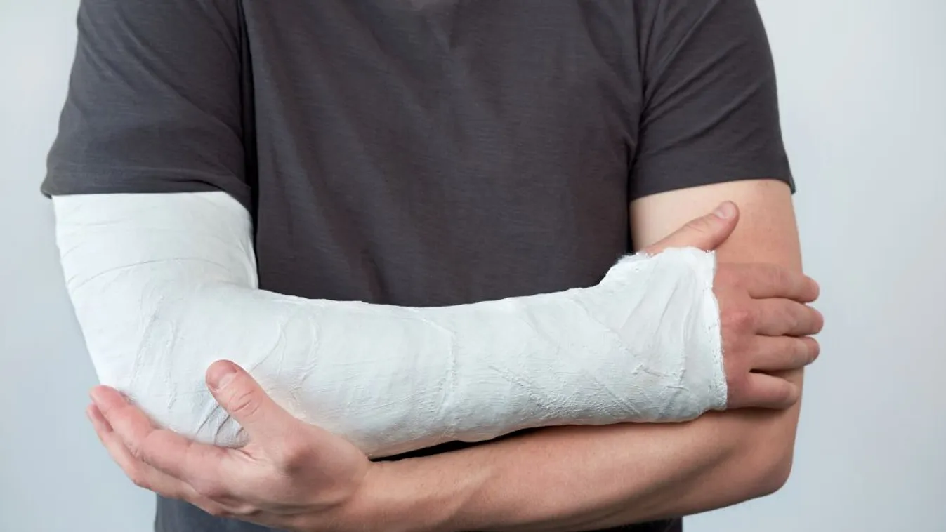 Gipszelt kézzel verte nyakon a sétálót