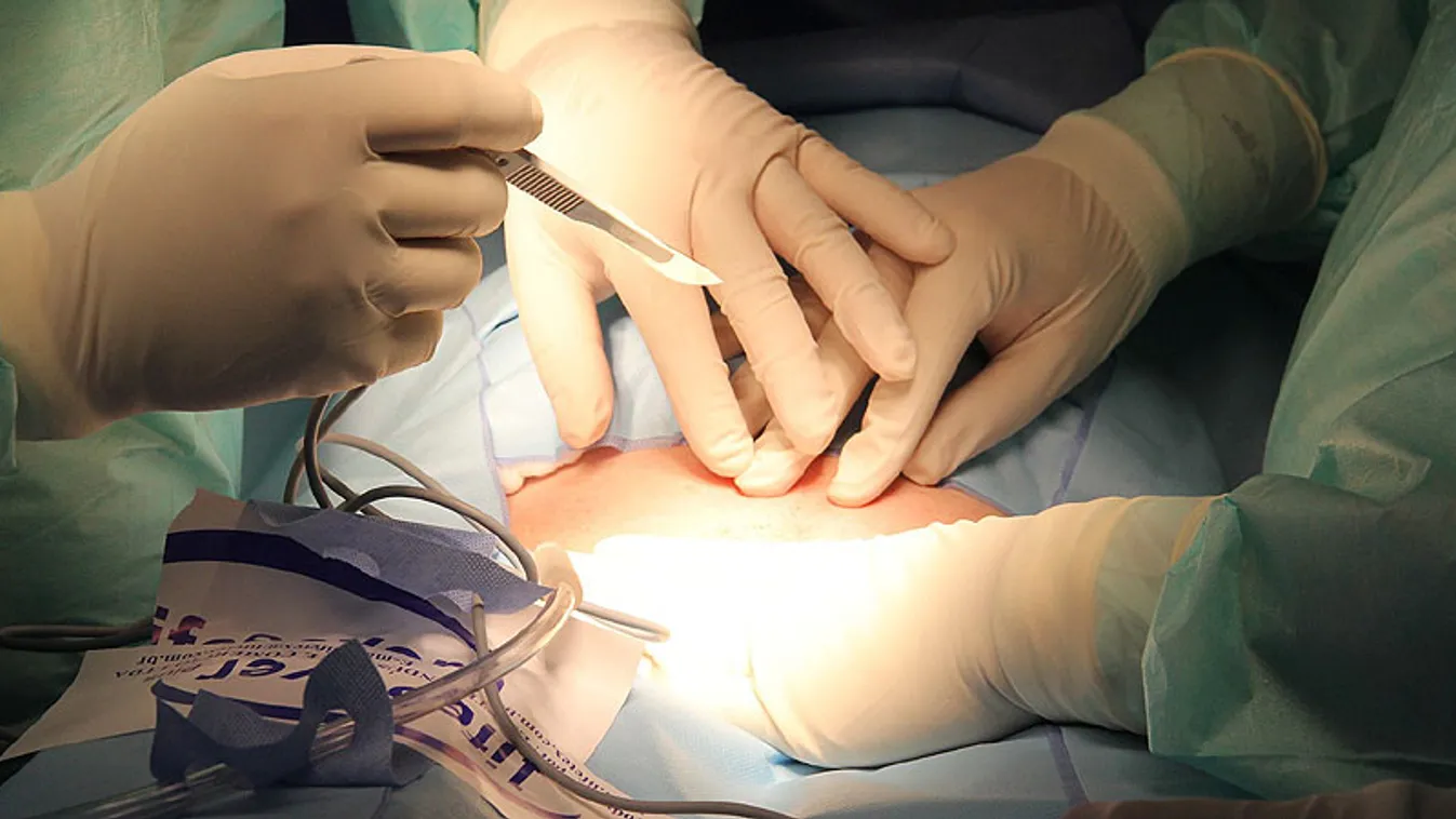 Tiltott orvosi beavatkozás okozott maradandó fogyatékosságot egy férfi nemiszervén