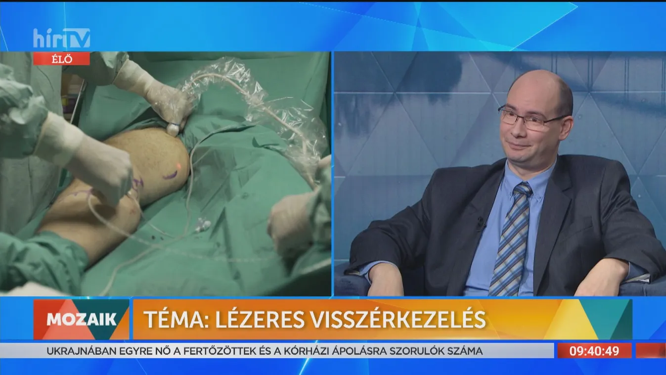 Mozaik - Lézeres visszérkezelés