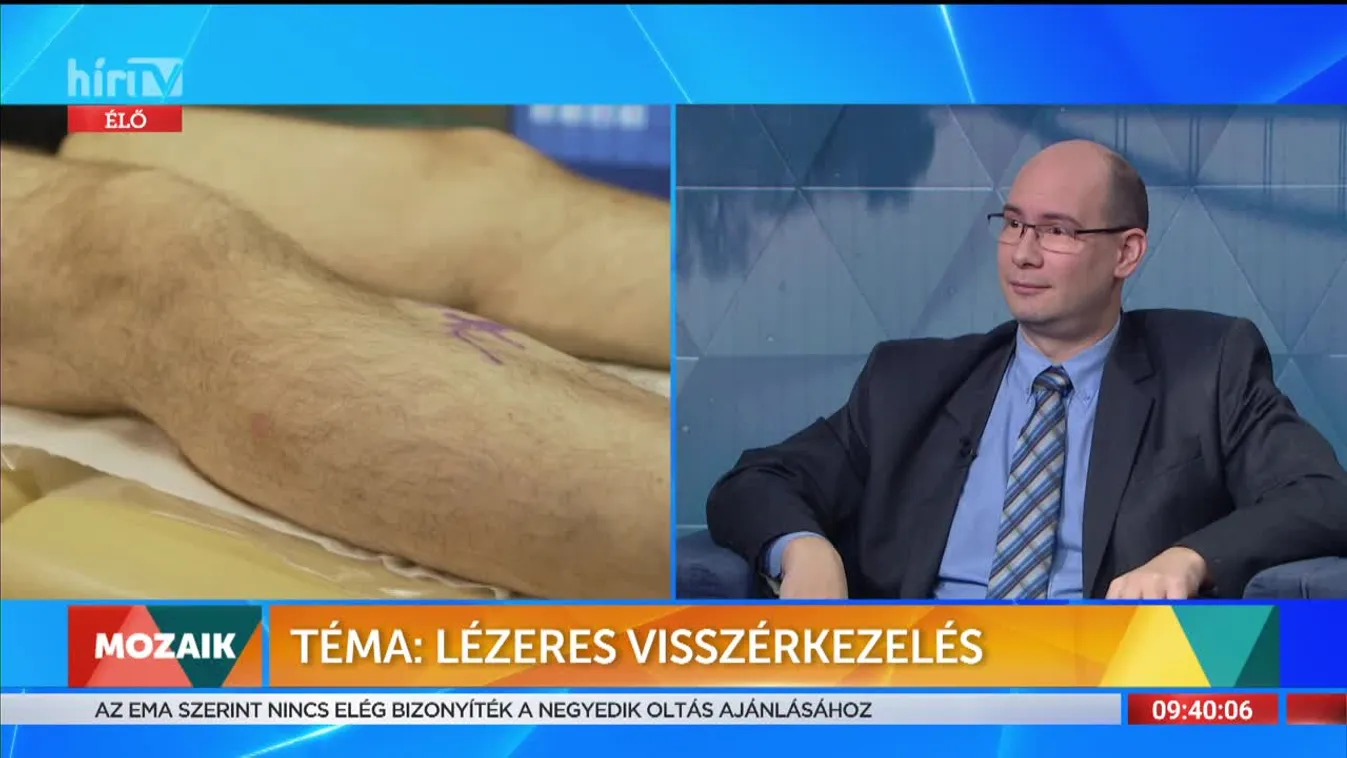 Mozaik - Lézeres visszérkezelés (2022-02-04)