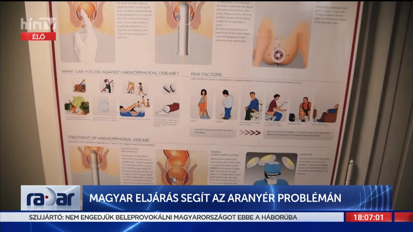 Radar - Magyar eljárás segít az aranyér problémán (2022-03-16)