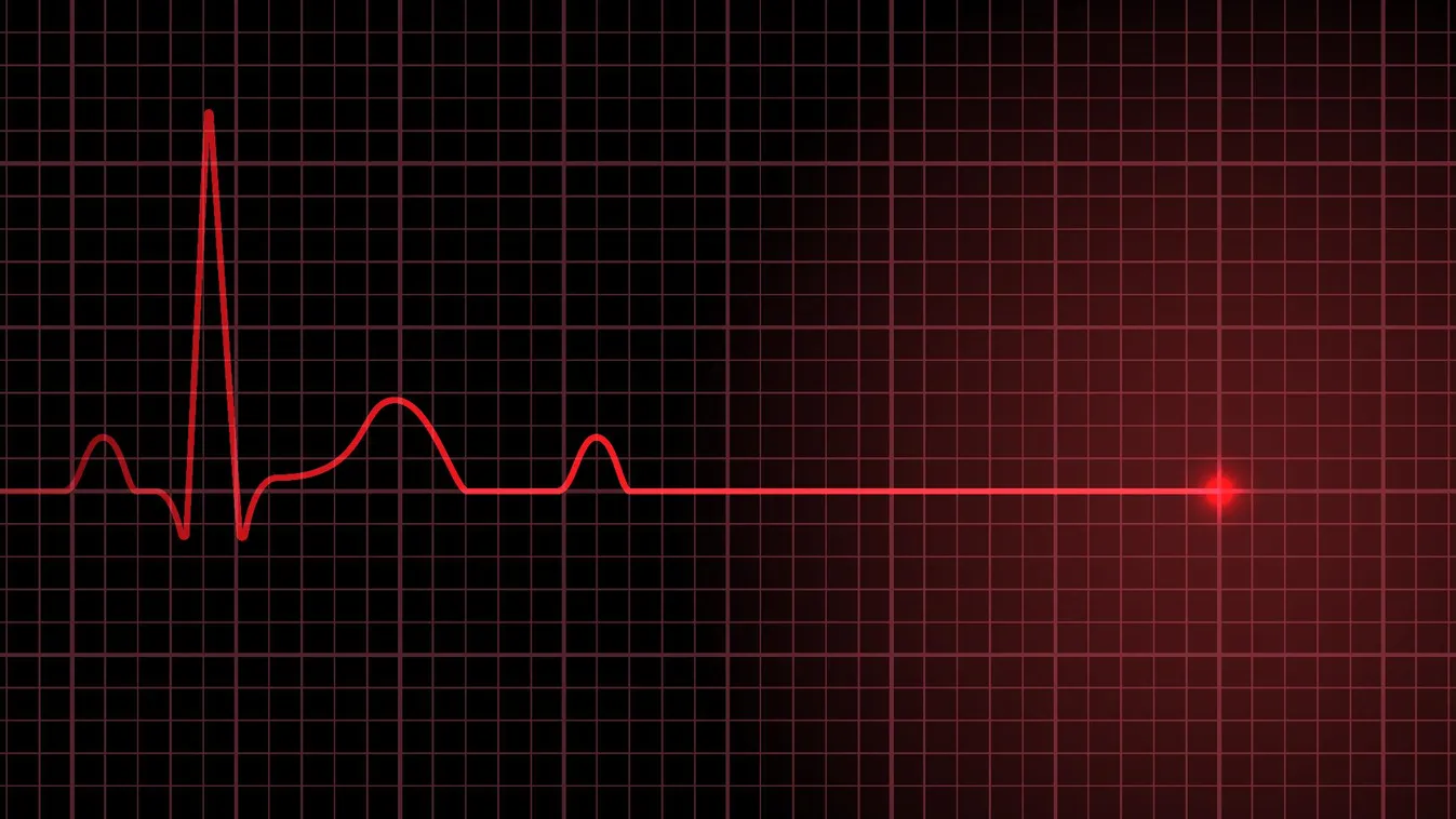 Tragédia történt: holtan esett össze az edzés előtti szertől az édesapa
