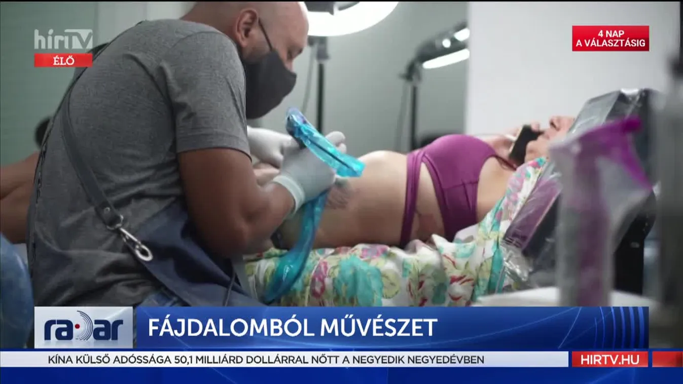Radar - Fájdalomból művészet (2022-03-30)