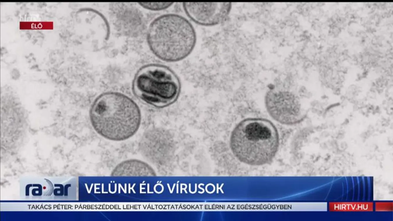 Radar - Velünk élő vírusok (2022-06-03)