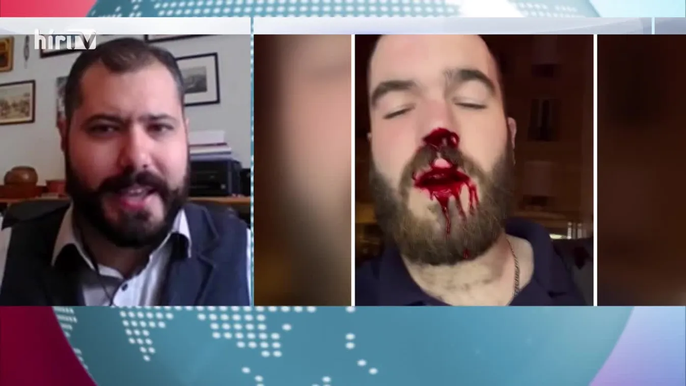 Globál (2022-10-22)