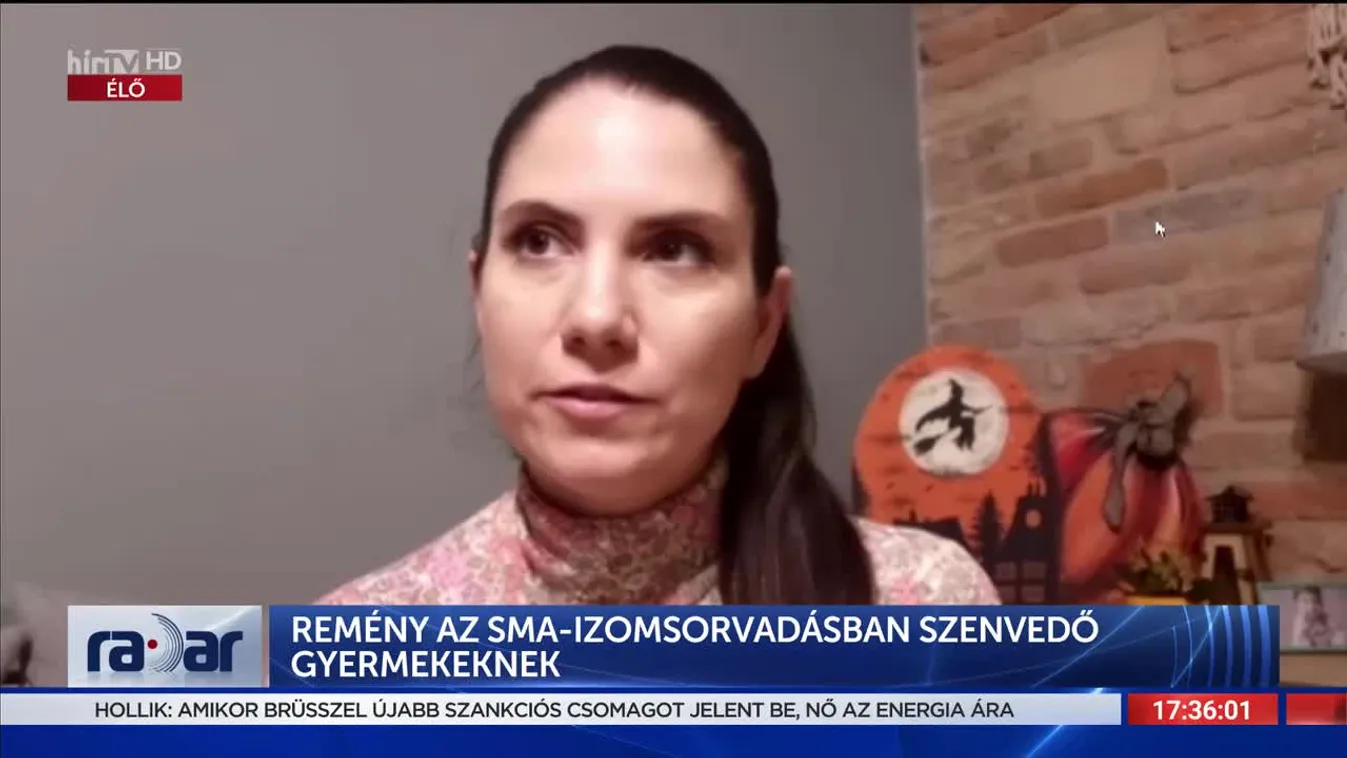 Remény az SMA-izomsorvadásban szenvedő gyermekeknek