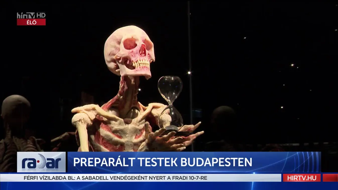 Radar - Preparált testek Budapesten (2022-11-17)