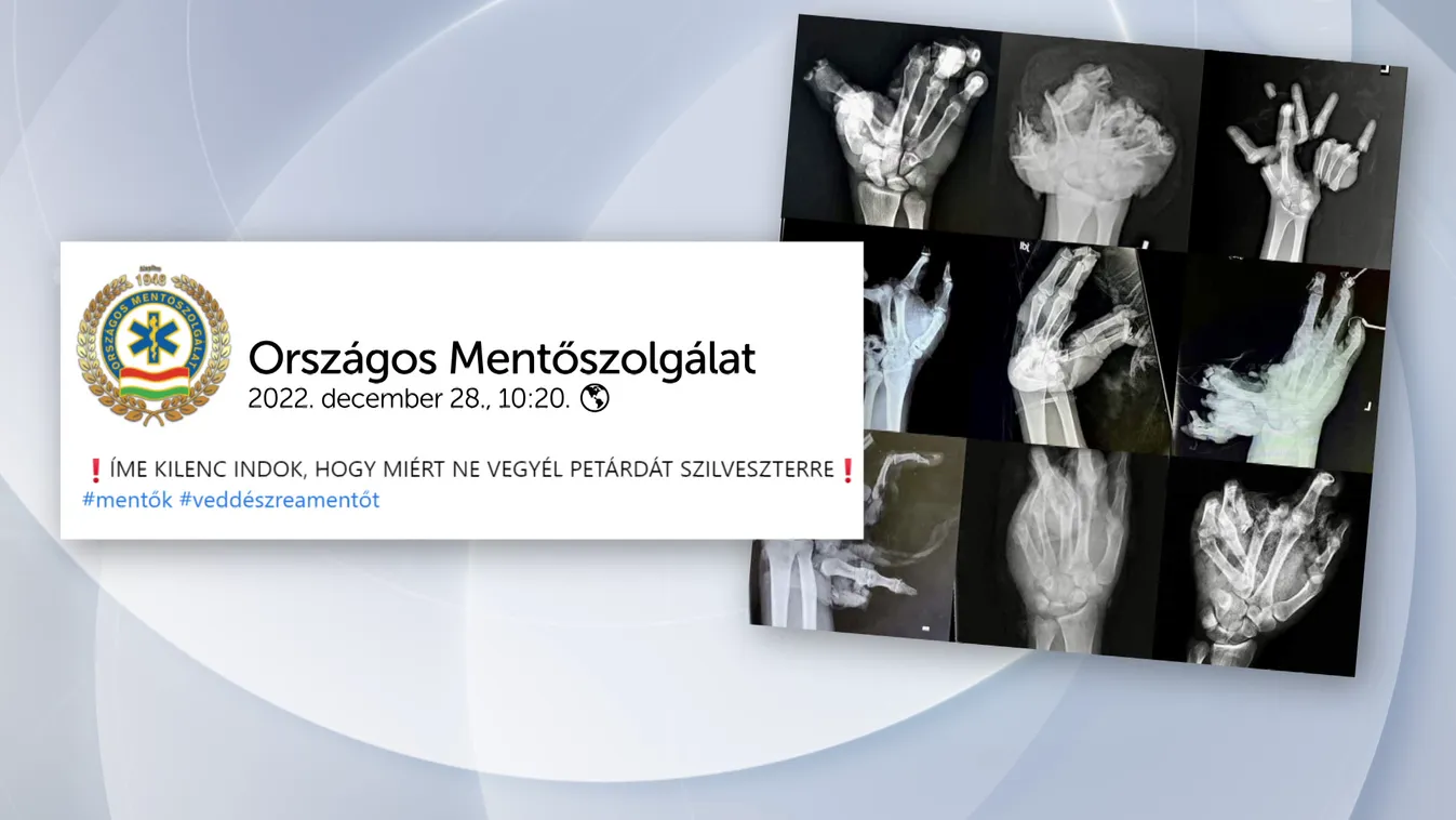 Országos Mentőszolgálat: 9 indok, hogy miért ne vegyél petárdát szilveszterre