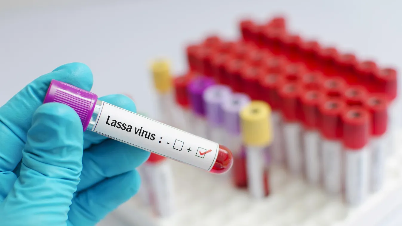 Nőtt a Lassa-láz halálos áldozatainak száma Nigériában