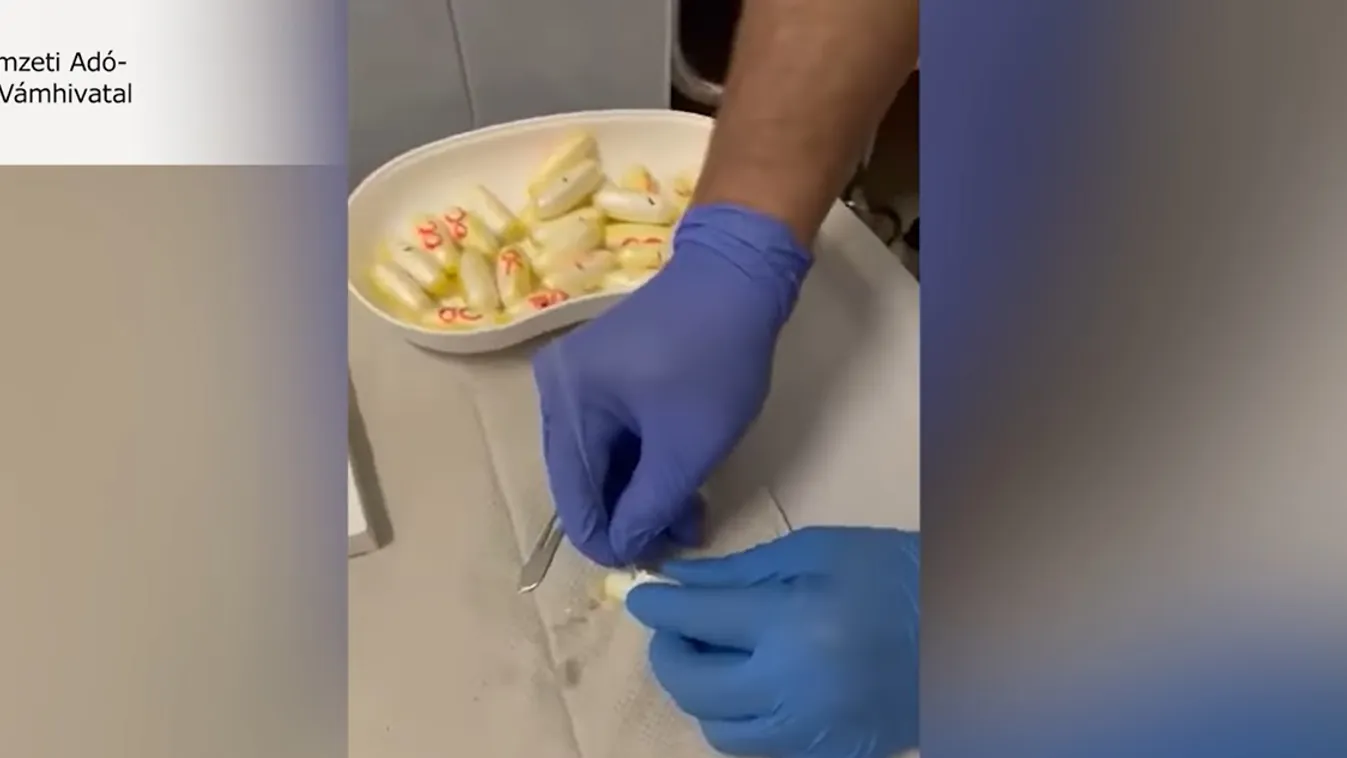 Kapszulákat lenyelve próbált kokaint becsempészni egy Sierra Leone-i férfi