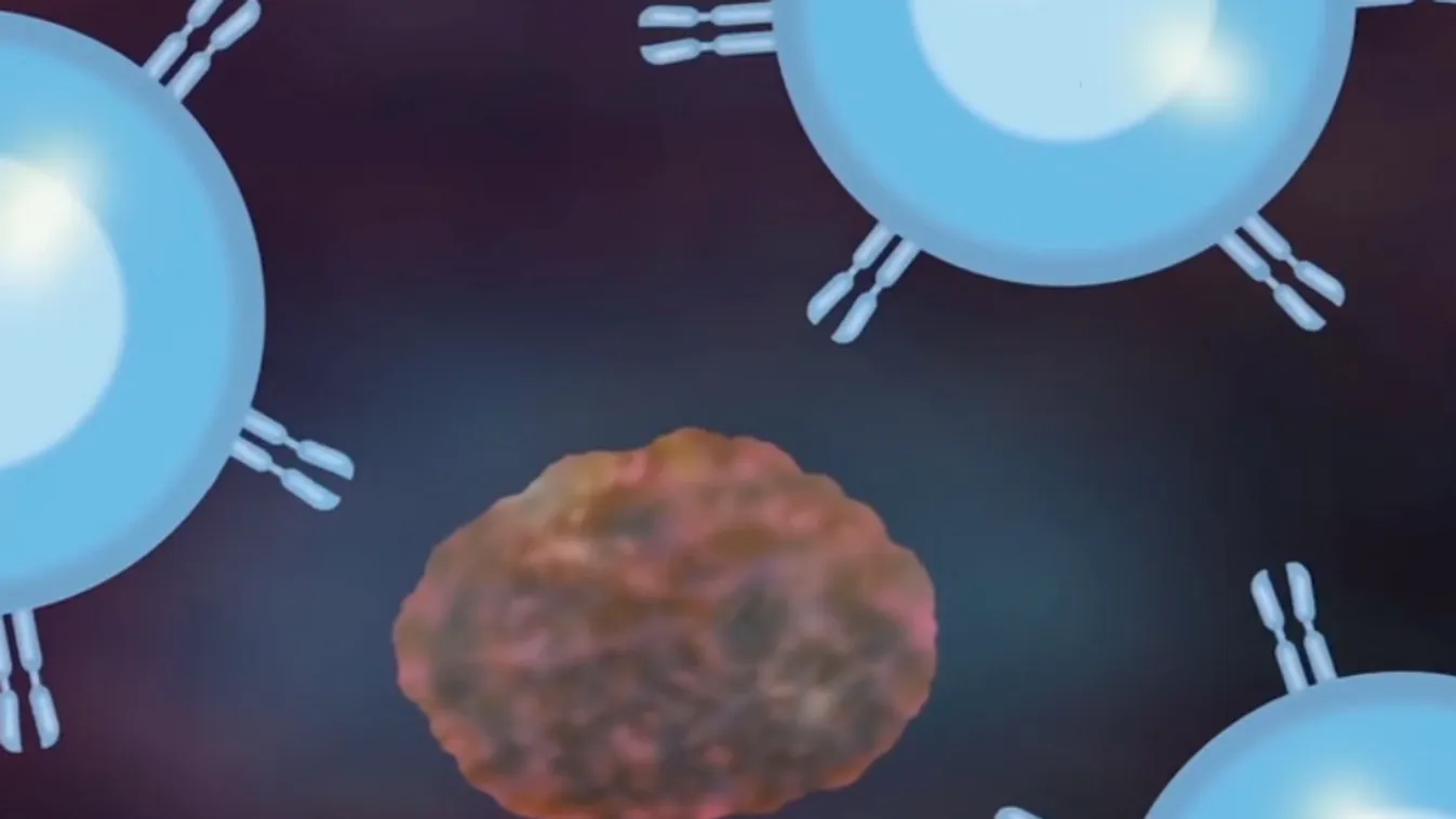 Radar - Előrelépés a leukémia kezelésében