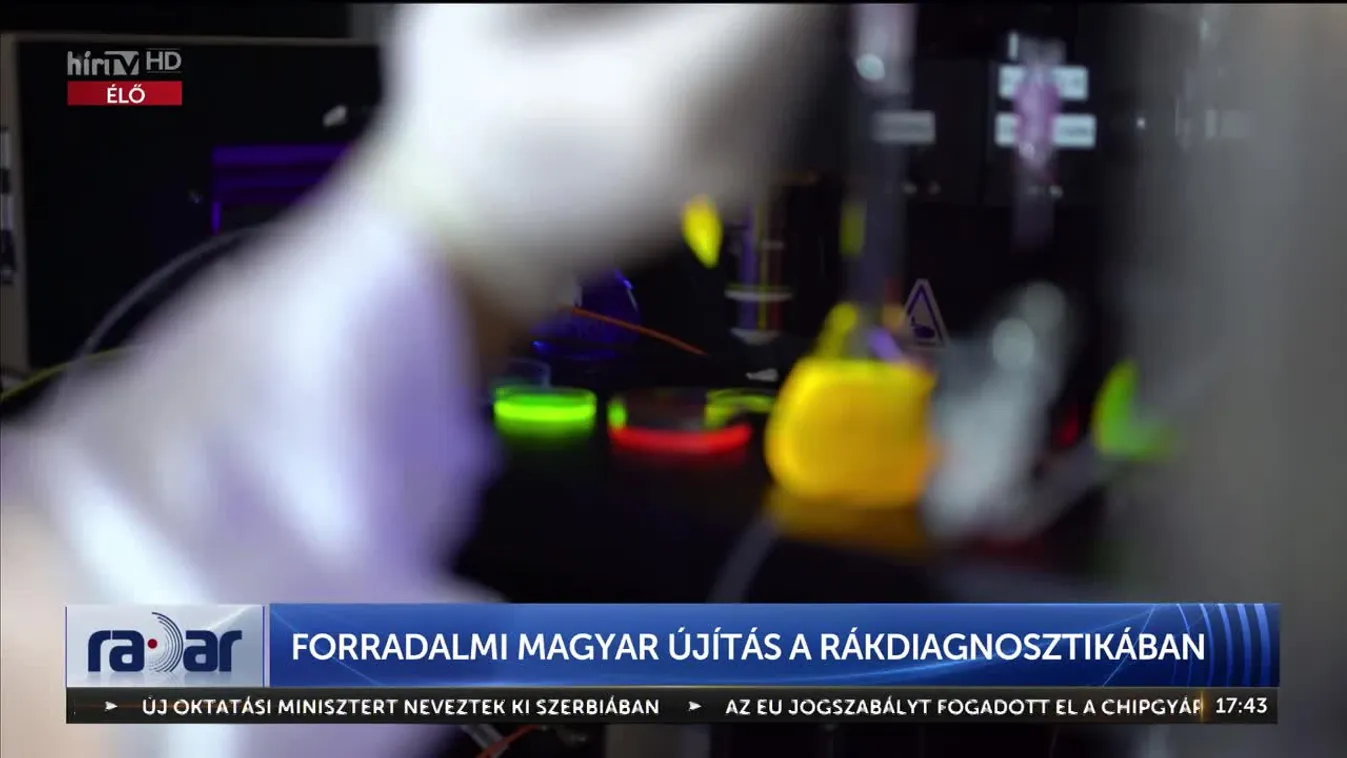 Radar - Forradalmi magyar újítás a rákdiagnosztikában (2023-07-25)