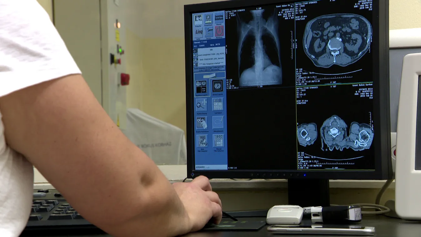 Radar - Világszintű gerincgyógyászat Magyarországon