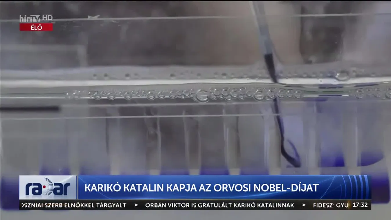 Radar - Karikó Katalin kapja az orvosi Nobel-díjat (2023-10-02)