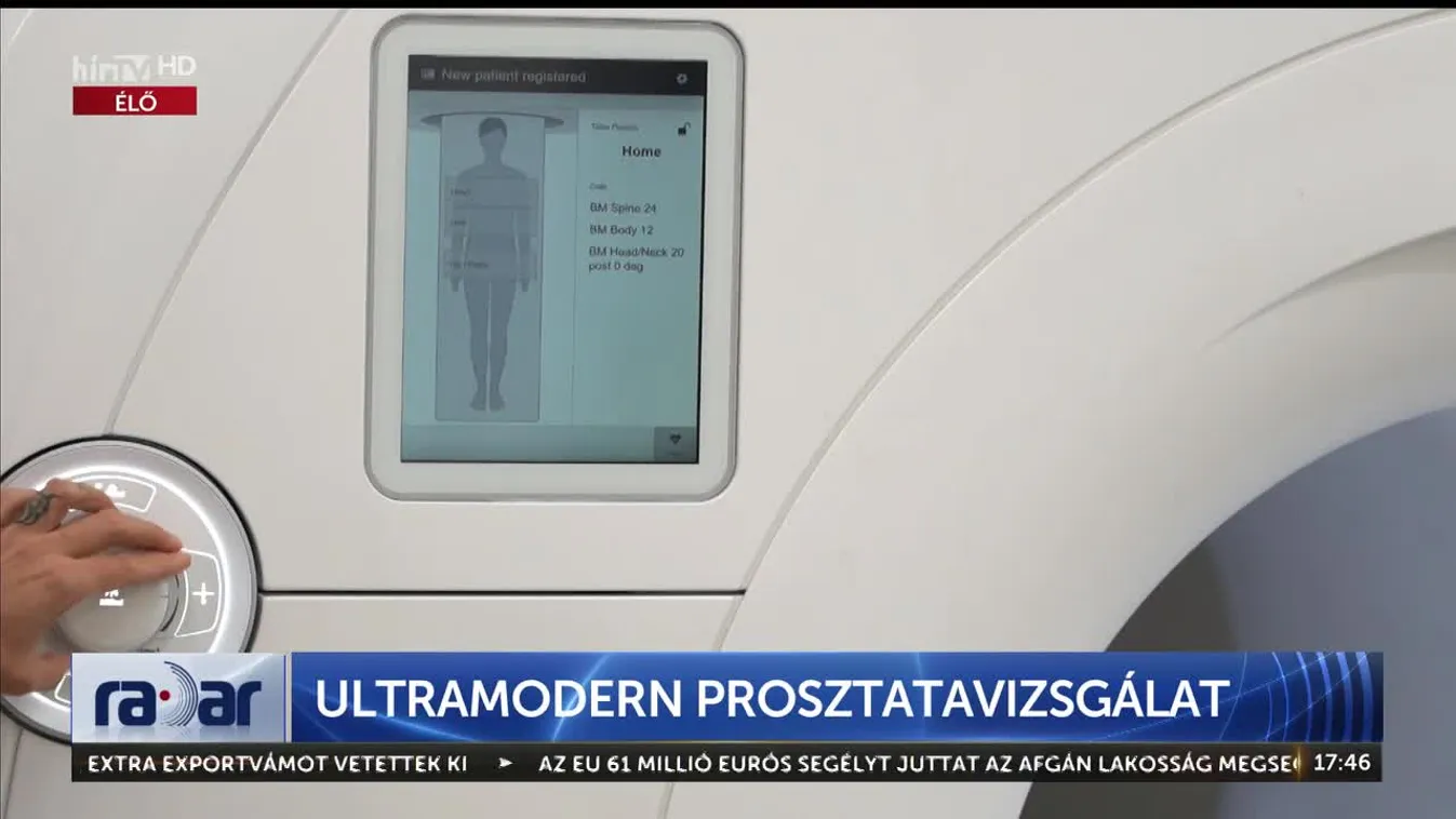 Radar - Ultramodern prosztatavizsgálat (2023-11-07)