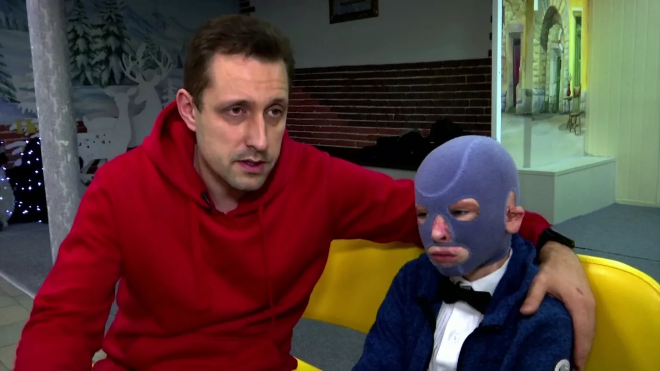 Radar - Felépült az orosz támadásban súlyosan megsérült ukrán kisfiú + videó